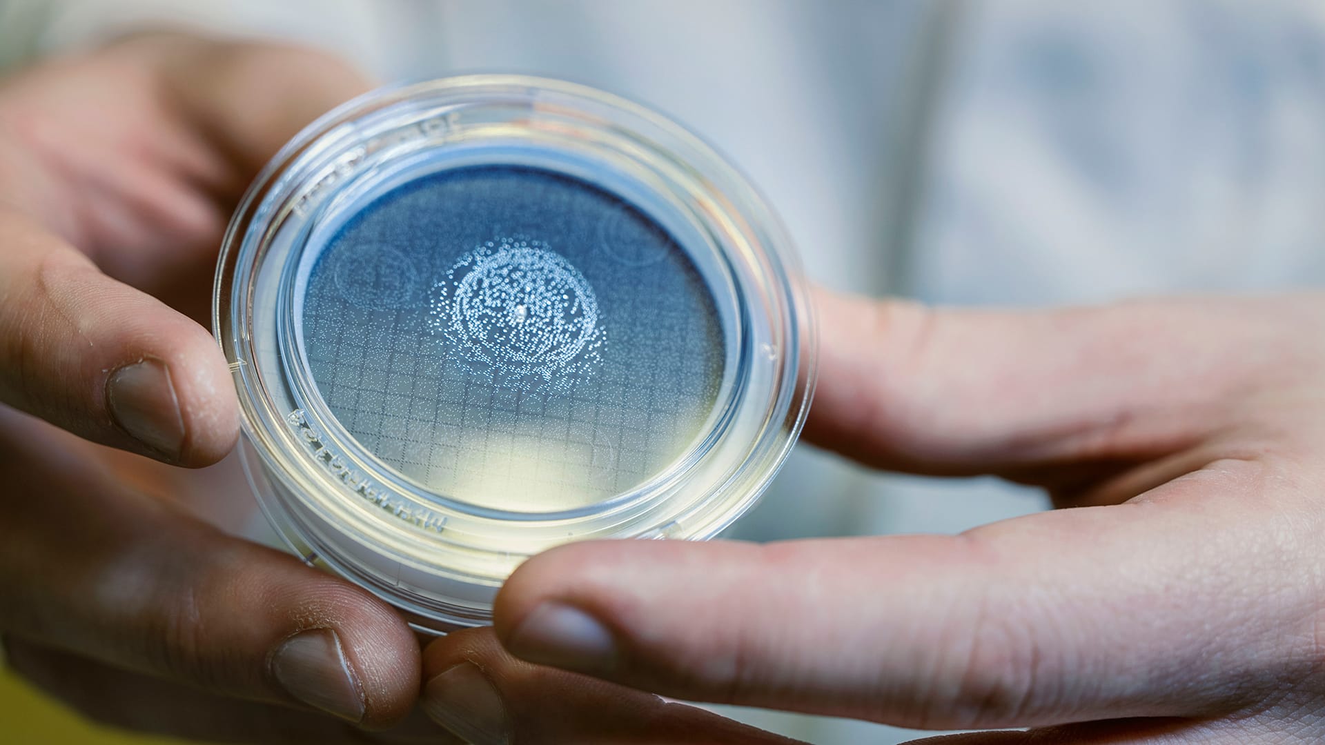 Two hands hold a sample of biomaterial into the camera